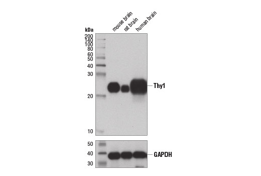 Western blot analysis of extracts from mouse, rat, and human brain using Thy1 (D3V8A) Rabbit mAb (upper) and GAPDH (D16H11) XP ® Rabbit mAb #5174 (lower).