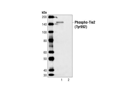 Western blot analysis of extracts from 293 cells, transfected with wild-type Tie2 (lane 1) or mock-transfected (lane 2), using Phospho-Tie2 (Tyr992) Antibody. Tie2 is constitutively active when transfected into 293 cells.