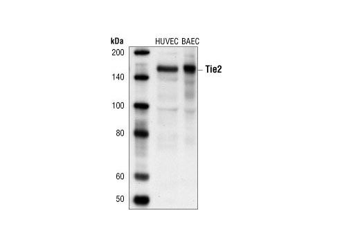 Western blot analysis of extracts from human umbilical vein endothelial cells (HUVEC) and bovine aortic endothelial cells (BAEC), using Tie2 (AB33) Mouse mAb.