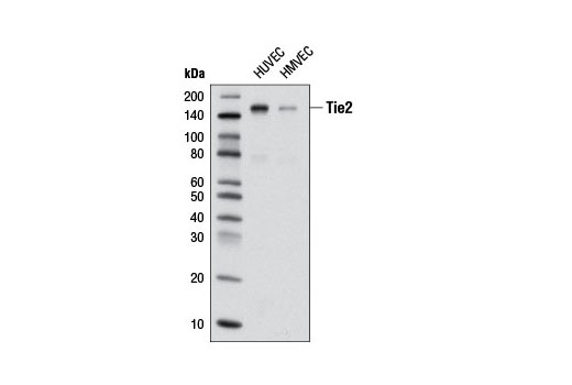 Western blot analysis of extracts from HUVEC and HMVEC cells using Tie2 (D9D10) Rabbit mAb.