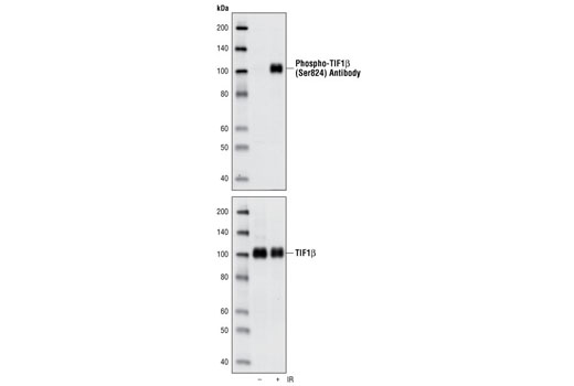Western blot analysis of extracts from HeLa cells, untreated or treated with ionizing radiation, using Phospho-TIF1β (Ser824) Antibody (upper) and TIF1β Antibody #4123 (lower).
