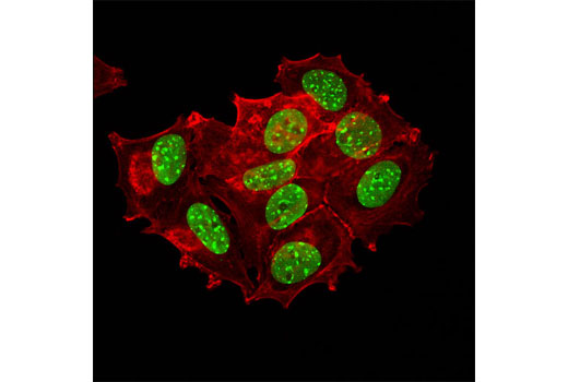 Confocal immunofluorescent analysis of MCF7 cells using TIF1β (4E1) Mouse mAb (green). Actin filaments were labeled with DY-554 phalloidin (red).