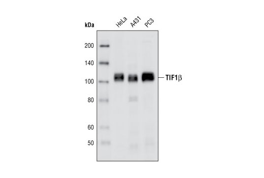 Western blot analysis of extracts from HeLa, A431 and PC3 cells using TIF1β antibody.