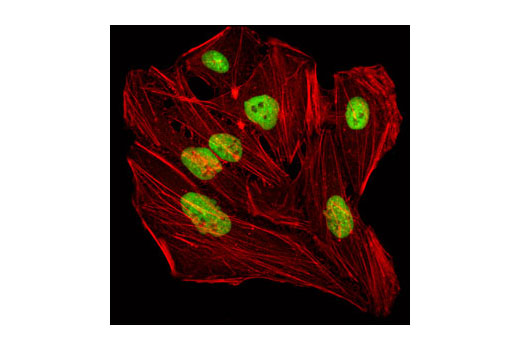 Confocal immunofluorescent analysis of HeLa cells using TIF1beta Antibody (green). Actin filaments have been labeled with Alexa Fluor® 555 phalloidin (red).