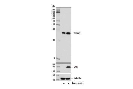 Western blot analysis of extracts from MCF7 cells, untreated (-) or treated with Doxorubicin #5927 (0.5 μM, 24 hr; +), using TIGAR (D3F4A) Rabbit mAb (upper), p53 (7F5) Rabbit mAb #2527 (middle) or β-Actin (13E5) Rabbit mAb #4970 (lower).
