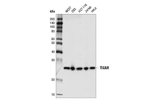 Western blot analysis of extracts from various cell lines using TIGAR (D3F4A) Rabbit mAb.