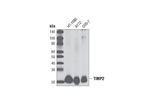 Western blot analysis of extracts from HT-1080, A172, and COS-7 cells using TIMP2 (D18B7) Rabbit mAb.