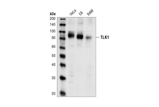 Western blot analysis of extracts from HeLa (human), C6 (rat), and RAW 264.7 (mouse) cells, using TLK1 Antibody.