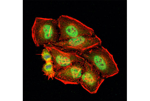 Confocal immunofluorescent analysis of HeLa cells using TLK1 Antibody (green). Actin filaments were labeled with DY-554 phalloidin (red). Blue pseudocolor = DRAQ5 ® #4084 (fluorescent DNA dye).