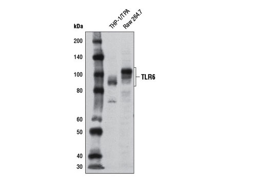 Western blot analysis of extracts from THP-1 cells differentiated overnight with 80 nM TPA (12-O-Tetradecanoylphorbol-13-Acetate) #4174 and Raw 264.7 cells using Toll-like Receptor 6 (D1Z8B) Rabbit mAb.