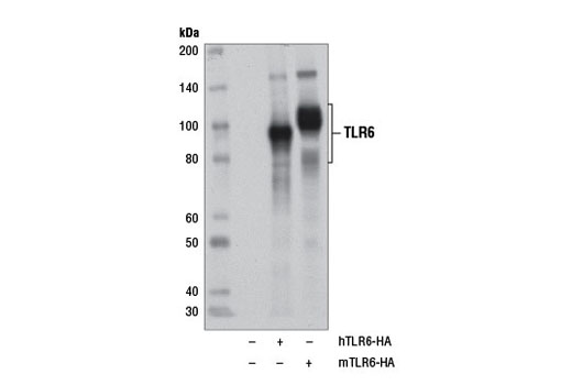 Western blot analysis of extracts from 293T cells, mock transfected (-) or transfected with a construct expressing HA-tagged full-length human TLR6 (hTLR6-HA; +) or transfected with a construct expressing HA-tagged full-length mouse TLR6 (mTLR6-HA; +), using Toll-like Receptor 6 (D1Z8B) Rabbit mAb.
