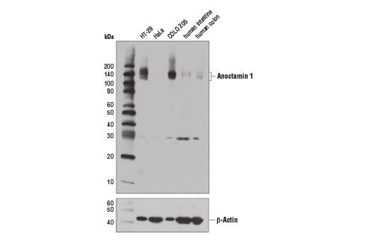 Western blot analysis of extracts from various tissues and cell lines using Anoctamin 1 (D1M9Q) Rabbit mAb (upper) and β-Actin (D6A8) Rabbit mAb #8457 (lower).