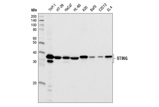 Western blot analysis of extracts from various cell lines using STING (D2P2F) Rabbit mAb.