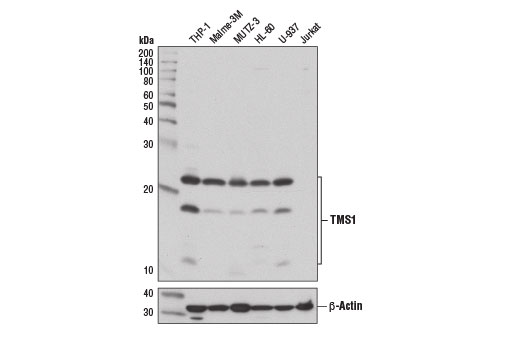 Western blot analysis of extracts from various cell lines using TMS1 (E1E3I) Rabbit mAb (upper) or β-Actin (D6A8) Rabbit mAb #8457 (lower). As expected, Jurkat cells do not express TMS1.