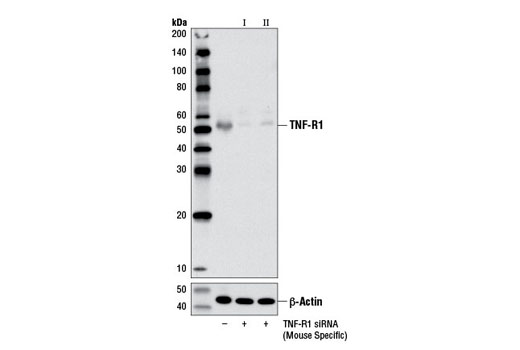 Western blot analysis of extracts from L-929 cells, transfected with 100 nm SignalSilence ® Control siRNA (Unconjugated) #6568 (-), SignalSilence ® TNF-R1 siRNA I (Mouse Specific) #13369 (+), or SignalSilence ® TNF-R1 siRNA II (Mouse Specific) #13570 (+), using TNF-R1 (D3I7K) Rabbit mAb (Rodent Specific) (upper) or β-Actin (D6A8) Rabbit mAb #8457 (lower). The TNF-R1 (D3I7K) Rabbit mAb (Rodent Specific) confirms the silencing of the TNF-R1 expression, while the β-Actin (D6A8) Rabbit mAb is used as a loading control.