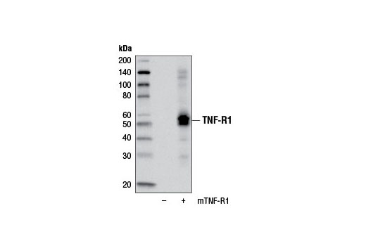 Western blot analysis of extracts from 293T cells, mock transfected (-) or transfected with a construct expressing full-length mouse TNF-R1 (mTNF-R1; +), using TNF-R1 (D3I7K) Rabbit mAb (Rodent Specific).