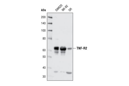Western blot analysis of extracts from SW620, NK-92 and SR cell lines, using TNF-R2 Antibody.