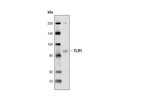 Western blot analysis of extracts from SR cells using Toll-like Receptor 1 Antibody.