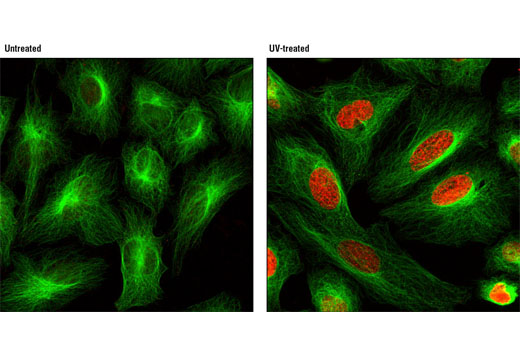  Confocal immunofluorescent analysis of HeLa cells, untreated (left) or UV-treated (right), using Phospho-Histone H2A.X (Ser139) (20E3) Rabbit mAb (Alexa Fluor® 555 Conjugate) (red) and β-Tubulin (9F3) Rabbit mAb (Alexa Fluor® 488 Conjugate) #3623 (green).