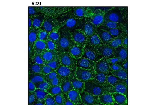 Confocal immunofluorescent analysis of unpermeabilized A-431 cells using DSG2 (10D2) Mouse mAb (IF Specific) (green). Blue pseudocolor = DRAQ5® #4084 (fluorescent DNA dye).