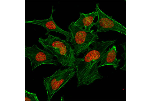  Confocal immunofluorescent analysis of HeLa cells using Pan-Methyl-Histone H3 (Lys9) (D54) XP® Rabbit mAb (Alexa Fluor® 647 Conjugate) (red). Actin filaments were labeled with Alexa Fluor® 488 Phalloidin #8878 (green).