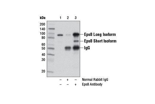 Immunoprecipitation of Eps8 from SK-MEL-5 cell extracts using Normal Rabbit IgG #2729 (lane 2) or Eps8 Antibody (lane 3). Lane 1 is 10% input. Western blot analysis was performed using Eps8 Antibody.