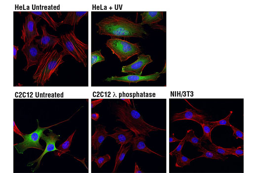 Confocal immunofluorescent analysis of HeLa cells, untreated (top left) or UV-treated (top right), C2C12 cells, untreated (bottom left) or treated with λ phosphatase (bottom middle), and NIH/3T3 cells (bottom right) using Phospho-HSP27 (Ser82) (D1H2F6) XP® Rabbit mAb (Alexa Fluor® 488 Conjugate) (green). Actin filaments were labeled with DY-554 phalloidin (red). Blue pseudocolor = DRAQ5® #4084 (fluorescent DNA dye). Negative staining in NIH/3T3 cells is in agreement with the observation that NIH/3T3 cells do not express HSP27 under basal conditions (5,7).