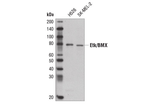 Western blot analysis of extracts from H526 and SK-MEL-2 cells using Etk/BMX Antibody.