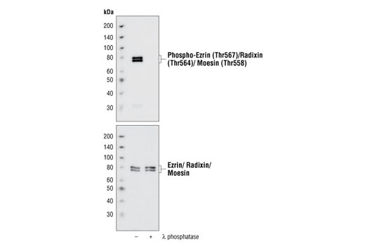 Western blot analysis of untreated or λ phosphatase treated A431 cells using Phospho-Ezrin (Thr567)/Radixin (Thr564)/Moesin (Thr558) (41A3) Rabbit mAb (upper) and Ezrin/Radixin/Moesin Antibody #3142 (lower).