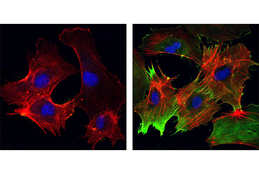 Confocal immunofluorescent analysis of HUVE cells, untreated (left) or TNF-α-treated (#8902, right), using Phospho-Ezrin (Thr567)/Radixin (Thr564)/Moesin (Thr558) (41A3) Rabbit mAb (green). Actin filaments have been labeled with DY-554 phalloidin (red). Blue pseudocolor = DRAQ5® #4084 (fluorescent DNA dye).