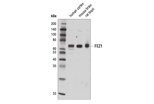 Western blot analysis of extracts from human cortex, mouse brain, and rat brain using FEZ1 Antibody.