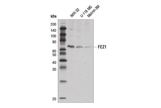 Western blot analysis of extracts from IMR-32, U-118 MG, and Malme-3M cell lines using FEZ1 Antibody.