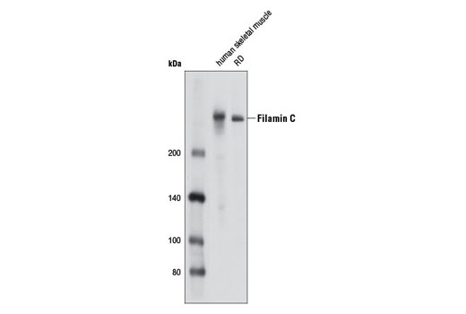 Western blot analysis of extracts from human skeletal muscle and RD cells using Filamin C Antibody.
