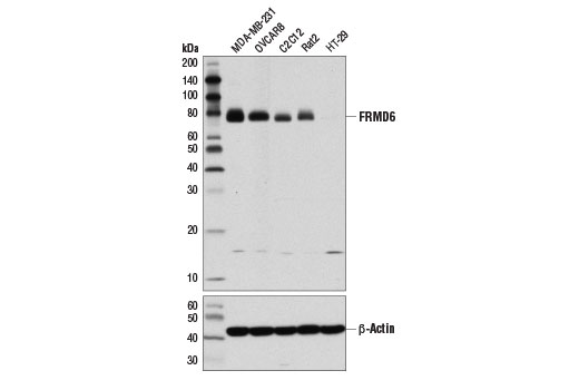 Western blot analysis of extracts from various cell lines using FRMD6 (D8X3R) Rabbit mAb (upper) and β-Actin (D6A8) Rabbit mAb #8457 (lower).