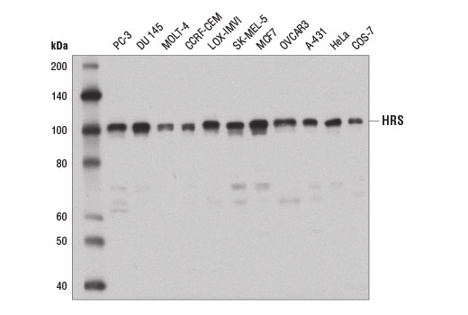 Western blot analysis of extracts from various cell lines using HRS Antibody.