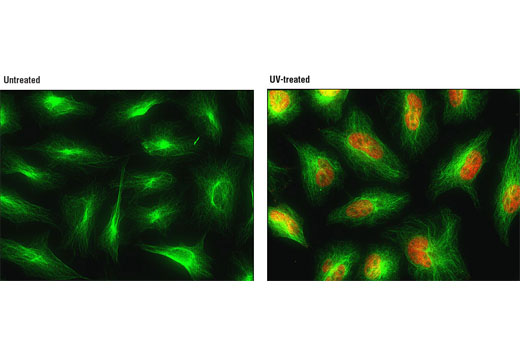 Immunofluorescent analysis of HeLa cells, untreated (left) or UV-treated (right), using Phospho-p38 MAPK (Thr180/Tyr182) (D3F9) XP® Rabbit mAb (Alexa Fluor® 555 Conjugate) (red) and β-Tubulin (9F3) Rabbit mAb (Alexa Fluor® 488 Conjugate) #3623 (green).