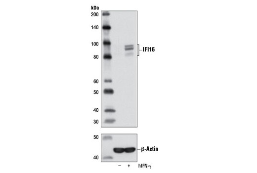 Western blot analysis of extracts from HL-60 cells, untreated (-) or treated (+) with Human Interferon-γ (hIFN-γ) #8901 (100 ng/mL, 16 hr), using IFI16 Antibody (upper) and β-Actin (D6A8) Rabbit mAb #8457 (lower).