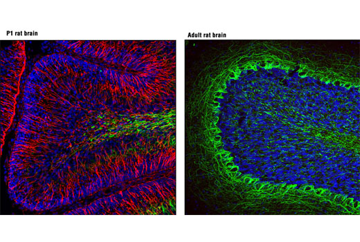  Confocal immunofluorescent analysis of P1 rat brain (left) and adult rat brain (right) using Nestin (Rat-401) Mouse mAb (Alexa Fluor® 594 Conjugate) (red) and Neurofilament-L (C28E10) Rabbit mAb (Alexa Fluor® 488 Conjugate) #8024 (green). Blue pseudocolor = DRAQ5® #4084 (fluorescent DNA dye).
