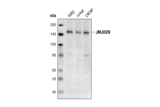 Western blot analysis of extracts from various cell lines using JMJD2B Antibody.