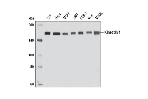 Western blot analysis of extracts from various cell lines using Kinectin 1 Antibody.