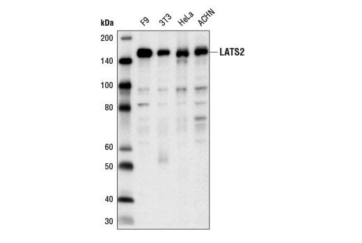 Western blot analysis of extracts from various cell lines using LATS2 Antibody.
