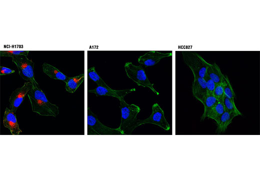 Confocal immunofluorescent analysis of NCI-H1703 (α+/β-; left), A172 (α-/β+; center), and HCC827 (α-/β-; right) cells using PDGF Receptor α (D13C6) XP® Rabbit mAb (Alexa Fluor® 594 Conjugate) (red). Actin filaments were labeled with Alexa Fluor® 488 phalloidin (green). Blue pseudocolor = DRAQ5® #4084 (fluorescent DNA dye).