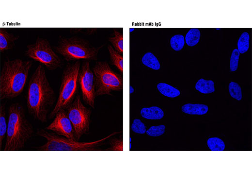  Confocal immunofluorescent analysis of HeLa cells using β-Tubulin (9F3) Rabbit mAb (Alexa Fluor® 594 Conjugate) #7634 (red; left) compared to concentration-matched Rabbit (DA1E) mAb IgG XP® Isotype Control (Alexa Fluor® 594 Conjugate) (right). Blue pseudocolor = DRAQ5® #4084 (fluorescent DNA dye).