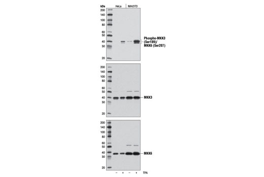Phospho-MKK3 (Ser189)/MKK6 (Ser207) Antibody #9231. Mouse Anti-rabbit IgG (Conformation Specific) (L27A9) mAb #3678 was used as a secondary antibody.