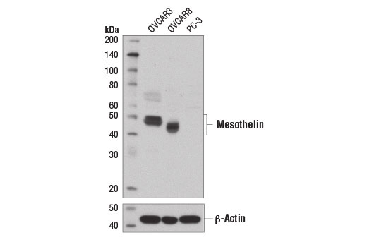 Western blot analysis of extracts from OVCAR8, OVCAR3, and PC-3 cell lines using Mesothelin Antibody (upper) and β-Actin (D6A8) Rabbit mAb #8457 (lower). As expected, mesothelin expression is not detected in PC3 cells.