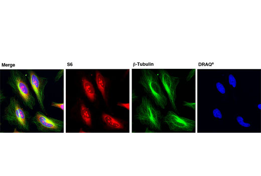 Confocal immunofluorescent analysis of HeLa cells using S6 Ribosomal Protein (54D2) Mouse mAb (Alexa Fluor® 555 Conjugate) (red) and β-Tubulin (9F3) Rabbit mAb (Alexa Fluor® 488 Conjugate) #3623 (green). Blue pseudocolor = DRAQ5® #4084 (fluorescent DNA dye).
