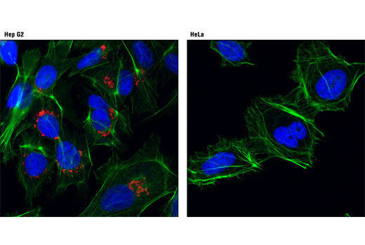 Confocal immunofluorescent analysis of Hep G2 (left) and HeLa (right) cells using AFP (3H8) Mouse mAb (Alexa Fluor® 647 Conjugate) (red). Actin filaments were labeled with Alexa Fluor® 488 phalloidin. Blue pseudocolor = DRAQ5® #4084 (fluorescent DNA dye).