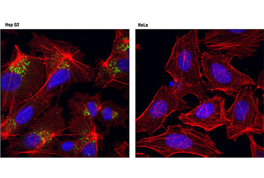 Confocal immunofluorescent analysis of Hep G2 (left) and HeLa (right) cells using AFP (3H8) Mouse mAb (Alexa Fluor® 488 Conjugate) (green). Actin filaments were labeled with DY-554 phalloidin (red). Blue pseudocolor = DRAQ5® #4084 (fluorescent DNA dye).