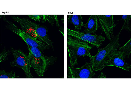 Confocal immunofluorescent analysis of Hep G2 (left) and HeLa (right) cells using AFP (3H8) Mouse mAb (Alexa Fluor® 594 Conjugate) (red). Actin filaments were labeled with Alexa Fluor® 488 phalloidin (green). Blue pseudocolor = DRAQ5® #4084 (fluorescent DNA dye).