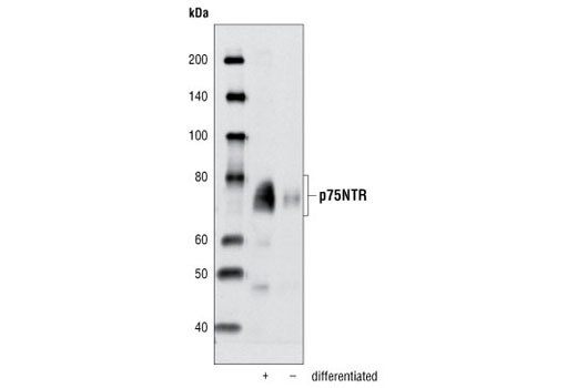 Western blot analysis of extracts from differentiated and undifferentiated RN33B cells using p75NTR Antibody.